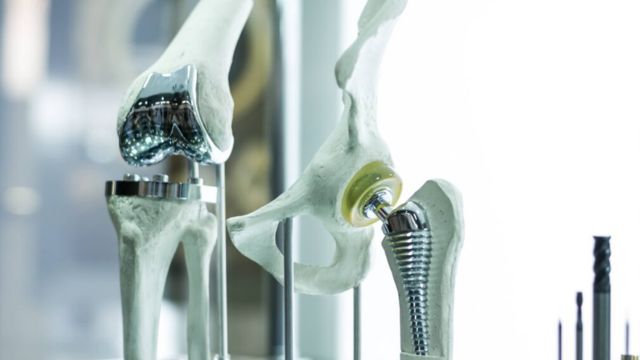 Biocompatibility in Medical Device Manufacturing: What You Need to Know
