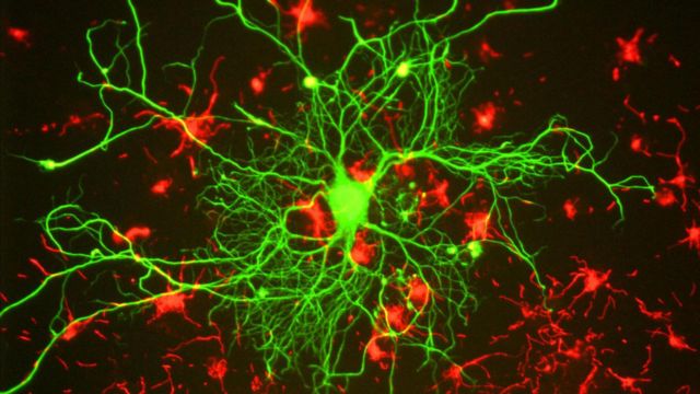 NIH Scientists Discover Brain Circuits Linked to Visual Clarity